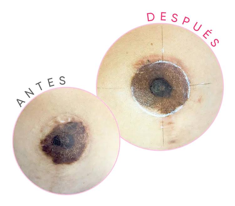 La Importancia de las Areolas Mamarias: Servicios Personalizados en Cejas Perfectas